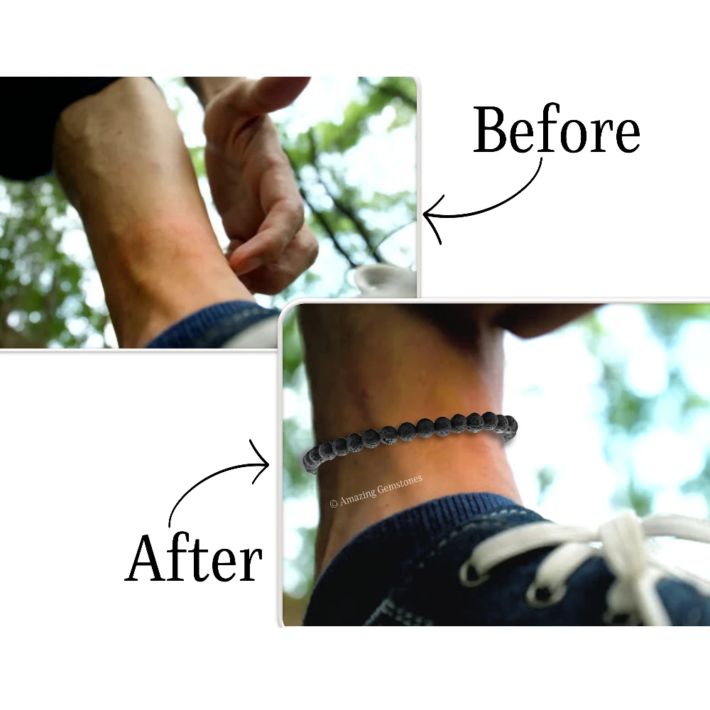 Lava Stone Mosquito Repellent Bracelet Anklet Set with Essential Oil (Pack of 2)