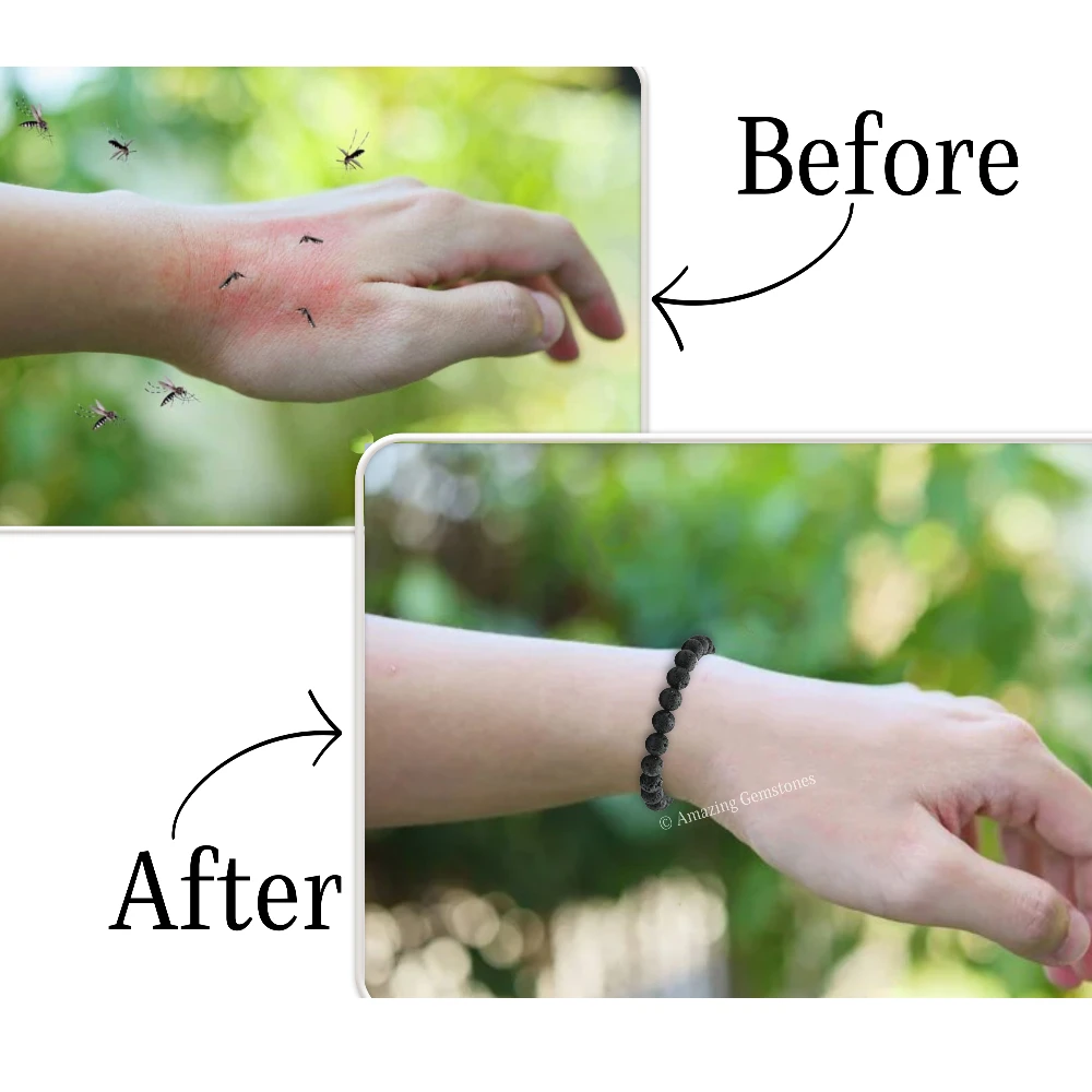 Lava Stone Mosquito Repellent Bracelet Anklet Set with Essential Oil (Pack of 2)